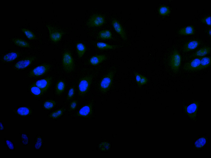 Immunofluorescence staining of A549 with CSB-RA069971A0HU at 1:20, counter-stained with DAPI. The cells were fixed in 4% formaldehyde and blocked in 10% normal Goat Serum. The cells were then incubated with the antibody overnight at 4°C. The secondary antibody was Alexa Fluor 520-congugated AffiniPure Goat Anti-Rabbit IgG(H+L).