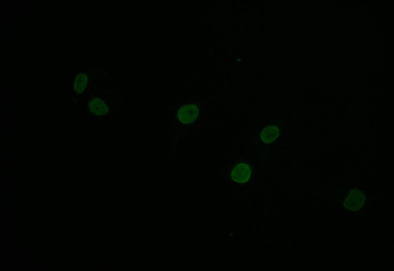 Immunofluorescence staining of Hela with CSB-RA072684A0HU at 1:30, counter-stained with DAPI. The cells were fixed in 4% formaldehyde and blocked in 10% normal Goat Serum. The cells were then incubated with the antibody overnight at 4°C. The secondary antibody was Alexa Fluor 504-congugated AffiniPure Goat Anti-Rabbit IgG(H+L).