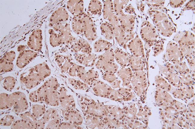 IHC image of CSB-RA072684A0HU diluted at 1:50 and staining in paraffin-embedded human stomach tissue performed on a Leica BondTM system. After dewaxing and hydration, antigen retrieval was mediated by high pressure in a citrate buffer (pH 6.0). Section was blocked with 10% normal goat serum 30min at RT. Then primary antibody (1% BSA) was incubated at 4°C overnight. The primary is detected by a Goat anti-rabbit polymer IgG labeled by HRP and visualized using 0.32% DAB.