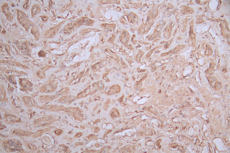 IHC image of CSB-RA095825A0HU diluted at 1:100 and staining in paraffin-embedded human kidney tissue performed on a Leica BondTM system. After dewaxing and hydration, antigen retrieval was mediated by high pressure in a citrate buffer (pH 6.0). Section was blocked with 10% normal goat serum 30min at RT. Then primary antibody (1% BSA) was incubated at 4°C overnight. The primary is detected by a Goat anti-rabbit polymer IgG labeled by HRP and visualized using 0.56% DAB.