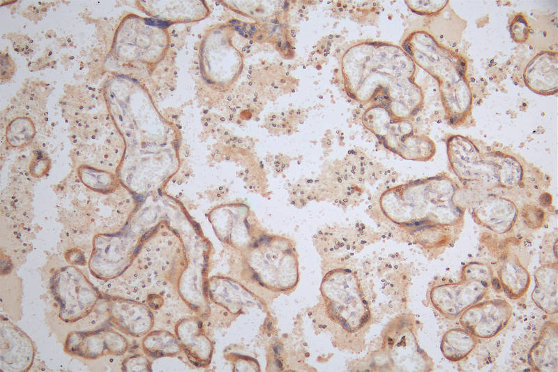 IHC image of CSB-RA111920A0HU diluted at 1:100 and staining in paraffin-embedded human placenta tissue performed on a Leica BondTM system. After dewaxing and hydration, antigen retrieval was mediated by high pressure in a citrate buffer (pH 6.0). Section was blocked with 10% normal goat serum 30min at RT. Then primary antibody (1% BSA) was incubated at 4°C overnight. The primary is detected by a Goat anti-rabbit polymer IgG labeled by HRP and visualized using 0.37% DAB.