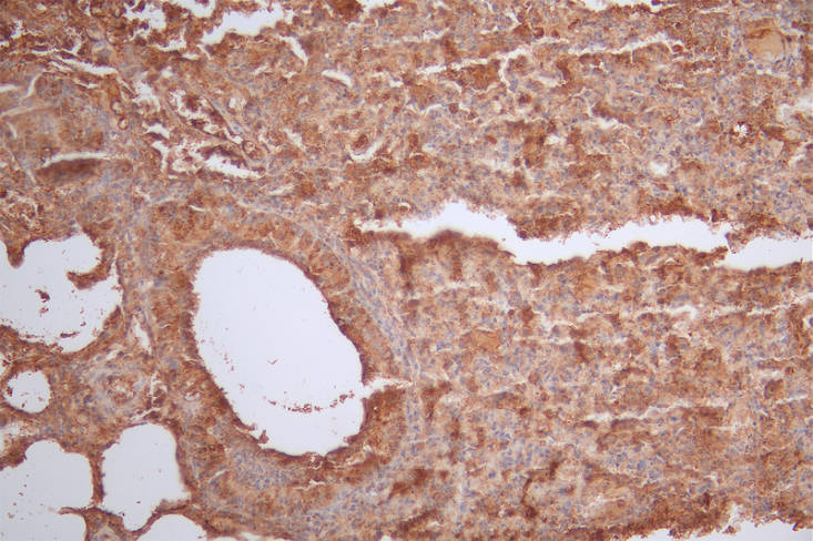 IHC image of CSB-RA116135A0HU diluted at 1:50 and staining in paraffin-embedded mouse lung tissue performed on a Leica BondTM system. After dewaxing and hydration, antigen retrieval was mediated by high pressure in a citrate buffer (pH 6.0). Section was blocked with 10% normal goat serum 30min at RT. Then primary antibody (1% BSA) was incubated at 4°C overnight. The primary is detected by a Goat anti-rabbit polymer IgG labeled by HRP and visualized using 0.53% DAB.