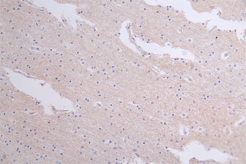 IHC image of CSB-RA18201:50A0HU diluted at 1:50 and staining in paraffin-embedded human brain tissue performed on a Leica BondTM system. After dewaxing and hydration, antigen retrieval was mediated by high pressure in a citrate buffer (pH 6.0). Section was blocked with 10% normal goat serum 30min at RT. Then primary antibody (1% BSA) was incubated at 4°C overnight. The primary is detected by a Goat anti-rabbit polymer IgG labeled by HRP and visualized using 0.60% DAB.