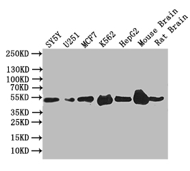 Western Blot Positive WB detected in: SY5Y whole cell lysate,U251 whole cell lysate,MCF7 whole cell lysate,K562 whole cell lysate,Mouse Brain tissue lysate,Mouse Brain tissue lysate All lanes: EGR2 antibody at 1:1000 Secondary Goat polyclonal to rabbit IgG at 1/50000 dilution Predicted band size: 50 kDa Observed band size: 50 kDa