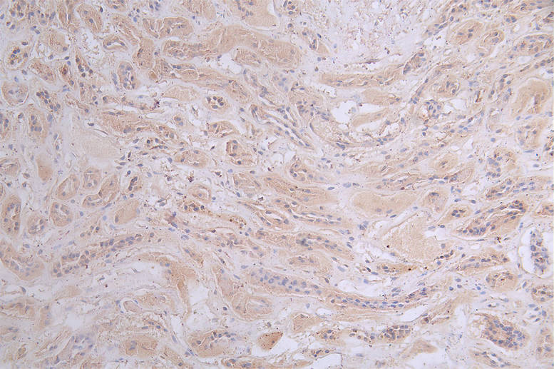 IHC image of CSB-RA197122A0HU diluted at 1:50 and staining in paraffin-embedded human kidney tissue performed on a Leica BondTM system. After dewaxing and hydration, antigen retrieval was mediated by high pressure in a citrate buffer (pH 6.0). Section was blocked with 10% normal goat serum 30min at RT. Then primary antibody (1% BSA) was incubated at 4°C overnight. The primary is detected by a Goat anti-rabbit polymer IgG labeled by HRP and visualized using 0.47% DAB.