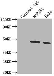 Immunoprecipitating MAP2K1 in Hela whole cell lysate Lane 1: Rabbit control IgG instead of CSB-RA225579A0HU in Hela whole cell lysate. For western blotting,a HRP-conjugated Protein G antibody was used as the secondary antibody (1/2000) Lane 2: CSB-RA225579A0HU(2microg)+ Hela whole cell lysate(500microg) Lane 3: Hela whole cell lysate (10microg)