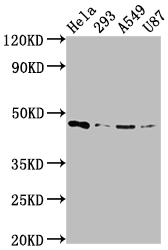 Western Blot Positive WB detected in: Hela whole cell lysate, 293 whole cell lysate, A549 whole cell lysate, U87 whole cell lysate All lanes: MAP2K1 antibody at 1:2000 Secondary Goat polyclonal to rabbit IgG at 1/50000 dilution Predicted band size: 44, 41 kDa Observed band size: 44 kDa