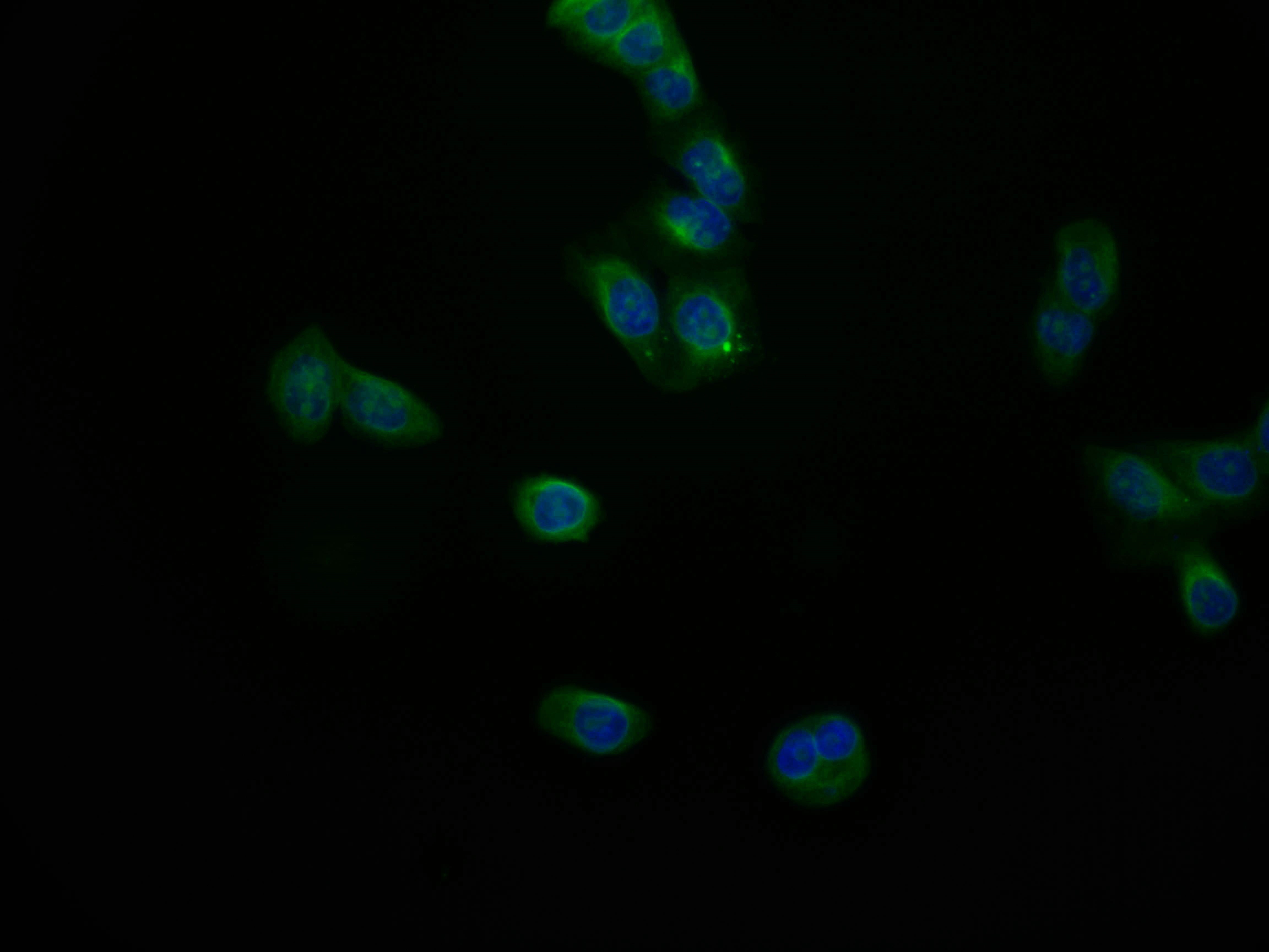 Immunofluorescence staining of PC-3 cell with CSB-RA240216A0HU at 1:50, counter-stained with DAPI. The cells were fixed in 4% formaldehyde and blocked in 10% normal Goat Serum. The cells were then incubated with the antibody overnight at 4°C. The secondary antibody was Alexa Fluor 553-congugated AffiniPure Goat Anti-Rabbit IgG(H+L).