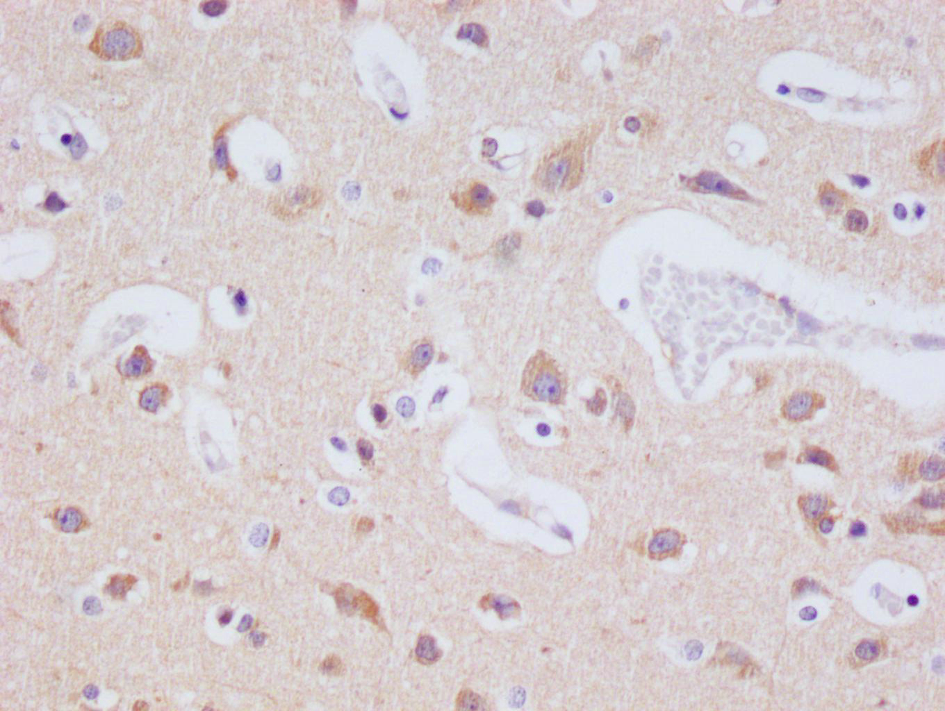 IHC image of CSB-RA240216A0HU diluted at 1:100 and staining in paraffin-embedded human brain tissue performed on a Leica BondTM system. After dewaxing and hydration, antigen retrieval was mediated by high pressure in a citrate buffer (pH 6.0). Section was blocked with 10% normal goat serum 30min at RT. Then primary antibody (1% BSA) was incubated at 4°C overnight. The primary is detected by a Goat anti-rabbit polymer IgG labeled by HRP and visualized using 0.05% DAB.