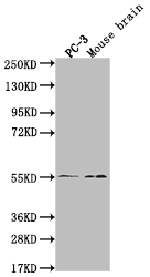 Western Blot Positive WB detected in: PC-3 whole cell lysate, Mouse brain tissue All lanes: MAPK10 antibody at 1:2000 Secondary Goat polyclonal to rabbit IgG at 1/50000 dilution Predicted band size: 53, 49, 32kDa Observed band size: 55 kDa