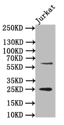 Western Blot Positive WB detected in: JK whole cell lysate All lanes: EBI3 antibody at 1:500 Secondary Goat polyclonal to rabbit IgG at 1/50000 dilution Predicted band size: 25 kDa Observed band size: 25 kDa