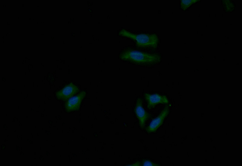 Immunofluorescence staining of HepG2 with CSB-RA262013A0HU at 1:40, counter-stained with DAPI. The cells were fixed in 4% formaldehyde and blocked in 10% normal Goat Serum. The cells were then incubated with the antibody overnight at 4°C. The secondary antibody was Alexa Fluor 503-congugated AffiniPure Goat Anti-Rabbit IgG(H+L).