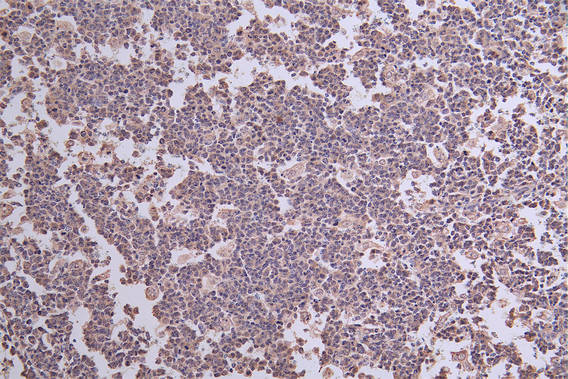 IHC image of CSB-RA262013A0HU diluted at 1:50 and staining in paraffin-embedded human tonsil tissue performed on a Leica BondTM system. After dewaxing and hydration, antigen retrieval was mediated by high pressure in a citrate buffer (pH 6.0). Section was blocked with 10% normal goat serum 30min at RT. Then primary antibody (1% BSA) was incubated at 4°C overnight. The primary is detected by a Goat anti-rabbit polymer IgG labeled by HRP and visualized using 0.30% DAB.