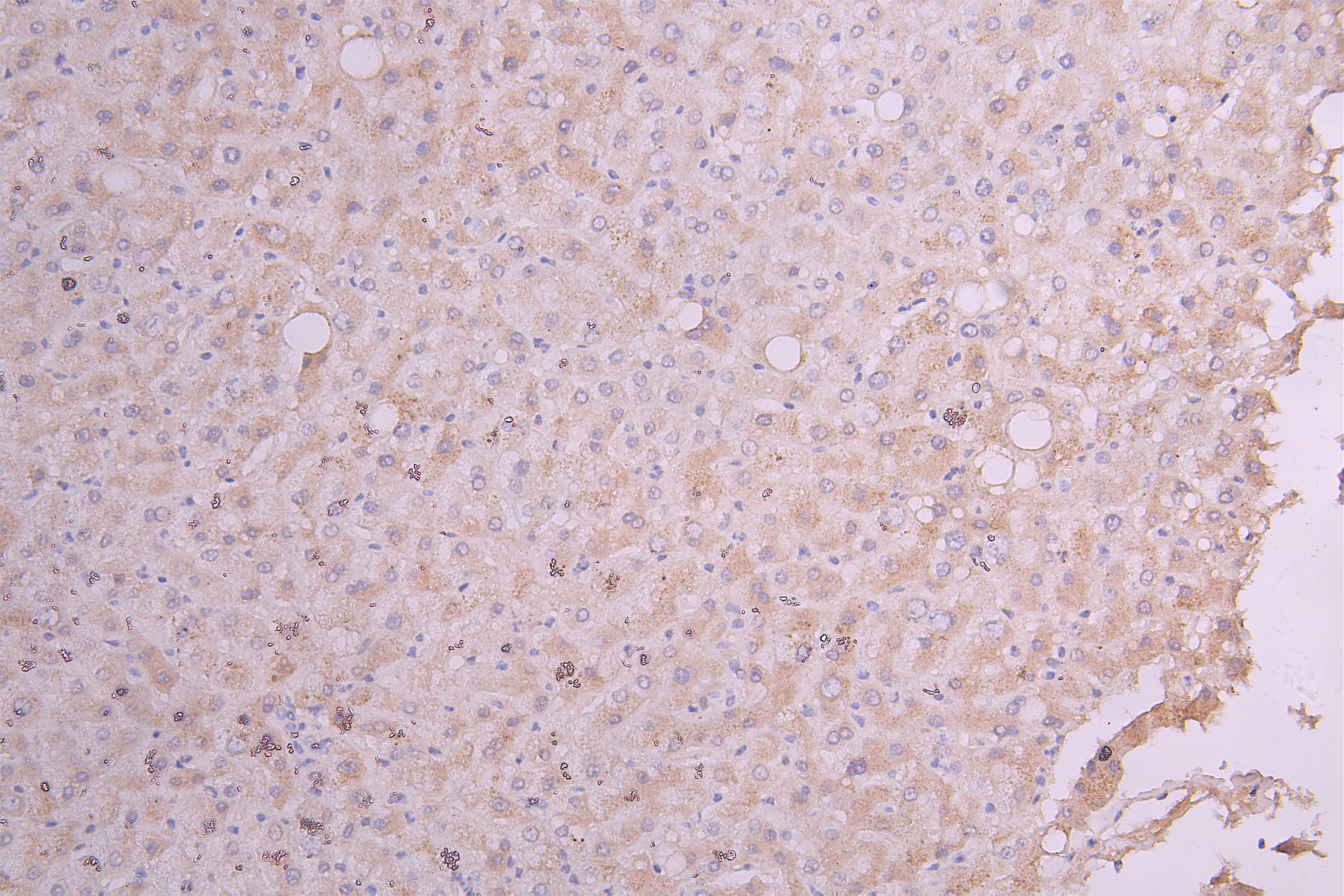 IHC image of CSB-RA356436MA1HU diluted at 1:100 and staining in paraffin-embedded human liver tissue performed on a Leica BondTM system. After dewaxing and hydration, antigen retrieval was mediated by high pressure in a citrate buffer (pH 6.0). Section was blocked with 10% normal goat serum 30min at RT. Then primary antibody (1% BSA) was incubated at 4°C overnight. The primary is detected by a Goat anti-Human IgG labeled by HRP and visualized using 0.05% DAB.