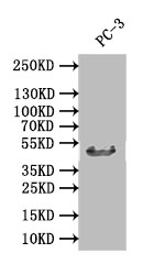 Western Blot Positive WB detected in: PC-3 whole cell lysate All lanes: DDB2 antibody at 1:1000 Secondary Goat polyclonal to rabbit IgG at 1/50000 dilution Predicted band size: 47 kDa Observed band size: 47 kDa