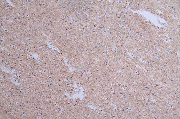 IHC image of CSB-RA549607A0HU diluted at 1:50 and staining in paraffin-embedded human brain tissue performed on a Leica BondTM system. After dewaxing and hydration, antigen retrieval was mediated by high pressure in a citrate buffer (pH 6.0). Section was blocked with 10% normal goat serum 30min at RT. Then primary antibody (1% BSA) was incubated at 4°C overnight. The primary is detected by a Goat anti-rabbit polymer IgG labeled by HRP and visualized using 0.1:50% DAB.