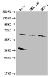 Western Blot Positive WB detected in: Hela whole cell lysate, HEK293 whole cell lysate, MCF-7 whole cell lysate All lanes: SMAD4 antibody at 1:500 Secondary Goat polyclonal to rabbit IgG at 1/50000 dilution Predicted band size: 61 kDa Observed band size: 55-72 kDa