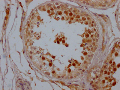 IHC image of CSB-RA556800A0HU diluted at 1:100 and staining in paraffin-embedded human testis tissue performed on a Leica BondTM system. After dewaxing and hydration, antigen retrieval was mediated by high pressure in a citrate buffer (pH 6.0). Section was blocked with 10% normal goat serum 30min at RT. Then primary antibody (1% BSA) was incubated at 4°C overnight. The primary is detected by a Goat anti-rabbit IgG polymer labeled by HRP and visualized using 0.05% DAB.