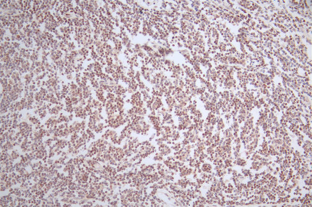 IHC image of CSB-RA561630A0HU diluted at 1:50 and staining in paraffin-embedded human tonsil tissue performed on a Leica BondTM system. After dewaxing and hydration, antigen retrieval was mediated by high pressure in a citrate buffer (pH 6.0). Section was blocked with 10% normal goat serum 30min at RT. Then primary antibody (1% BSA) was incubated at 4°C overnight. The primary is detected by a Goat anti-rabbit polymer IgG labeled by HRP and visualized using 0.52% DAB.