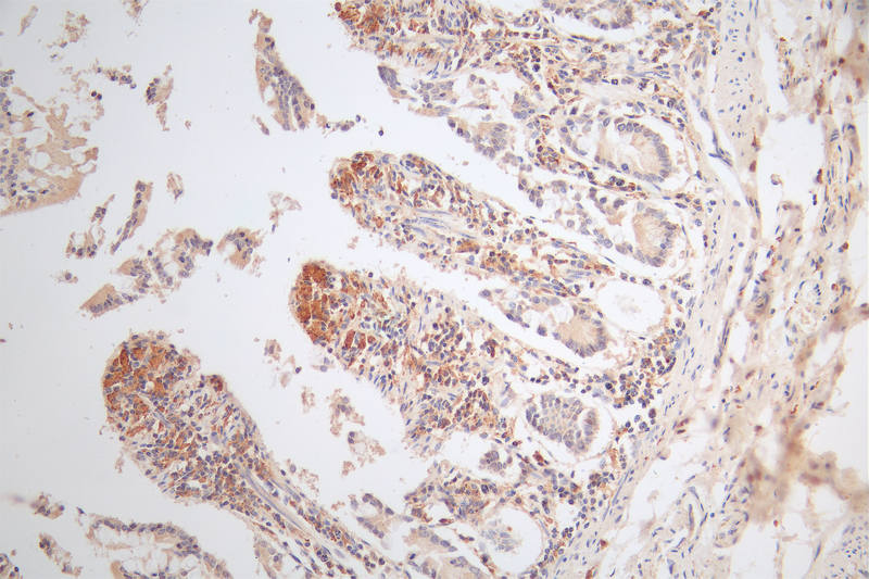 IHC image of CSB-RA574653A0HU diluted at 1:80 and staining in paraffin-embedded human small intestine tissue performed on a Leica BondTM system. After dewaxing and hydration, antigen retrieval was mediated by high pressure in a citrate buffer (pH 6.0). Section was blocked with 10% normal goat serum 30min at RT. Then primary antibody (1% BSA) was incubated at 4°C overnight. The primary is detected by a Goat anti-rabbit polymer IgG labeled by HRP and visualized using 0.49% DAB.