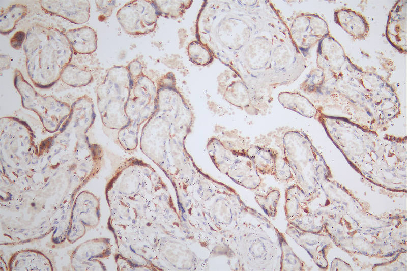 IHC image of CSB-RA579492A0HU diluted at 1:80 and staining in paraffin-embedded human placenta tissue performed on a Leica BondTM system. After dewaxing and hydration, antigen retrieval was mediated by high pressure in a citrate buffer (pH 6.0). Section was blocked with 10% normal goat serum 30min at RT. Then primary antibody (1% BSA) was incubated at 4°C overnight. The primary is detected by a Goat anti-rabbit polymer IgG labeled by HRP and visualized using 0.48% DAB.