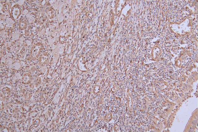 IHC image of CSB-RA583078A0HU diluted at 1:50 and staining in paraffin-embedded human lung tissue performed on a Leica BondTM system. After dewaxing and hydration, antigen retrieval was mediated by high pressure in a citrate buffer (pH 6.0). Section was blocked with 10% normal goat serum 30min at RT. Then primary antibody (1% BSA) was incubated at 4°C overnight. The primary is detected by a Goat anti-rabbit polymer IgG labeled by HRP and visualized using 0.24% DAB.