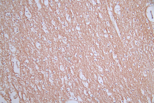 IHC image of CSB-RA588962A0HU diluted at 1:50 and staining in paraffin-embedded human brain tissue performed on a Leica BondTM system. After dewaxing and hydration, antigen retrieval was mediated by high pressure in a citrate buffer (pH 6.0). Section was blocked with 10% normal goat serum 30min at RT. Then primary antibody (1% BSA) was incubated at 4°C overnight. The primary is detected by a Goat anti-rabbit polymer IgG labeled by HRP and visualized using 0.76% DAB.