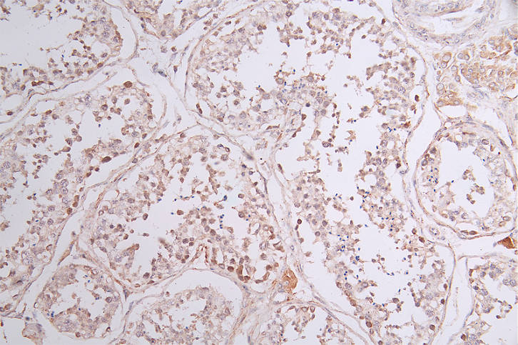 IHC image of CSB-RA594821A0HU diluted at 1:50 and staining in paraffin-embedded human testis tissue performed on a Leica BondTM system. After dewaxing and hydration, antigen retrieval was mediated by high pressure in a citrate buffer (pH 6.0). Section was blocked with 10% normal goat serum 30min at RT. Then primary antibody (1% BSA) was incubated at 4°C overnight. The primary is detected by a Goat anti-rabbit polymer IgG labeled by HRP and visualized using 0.43% DAB.