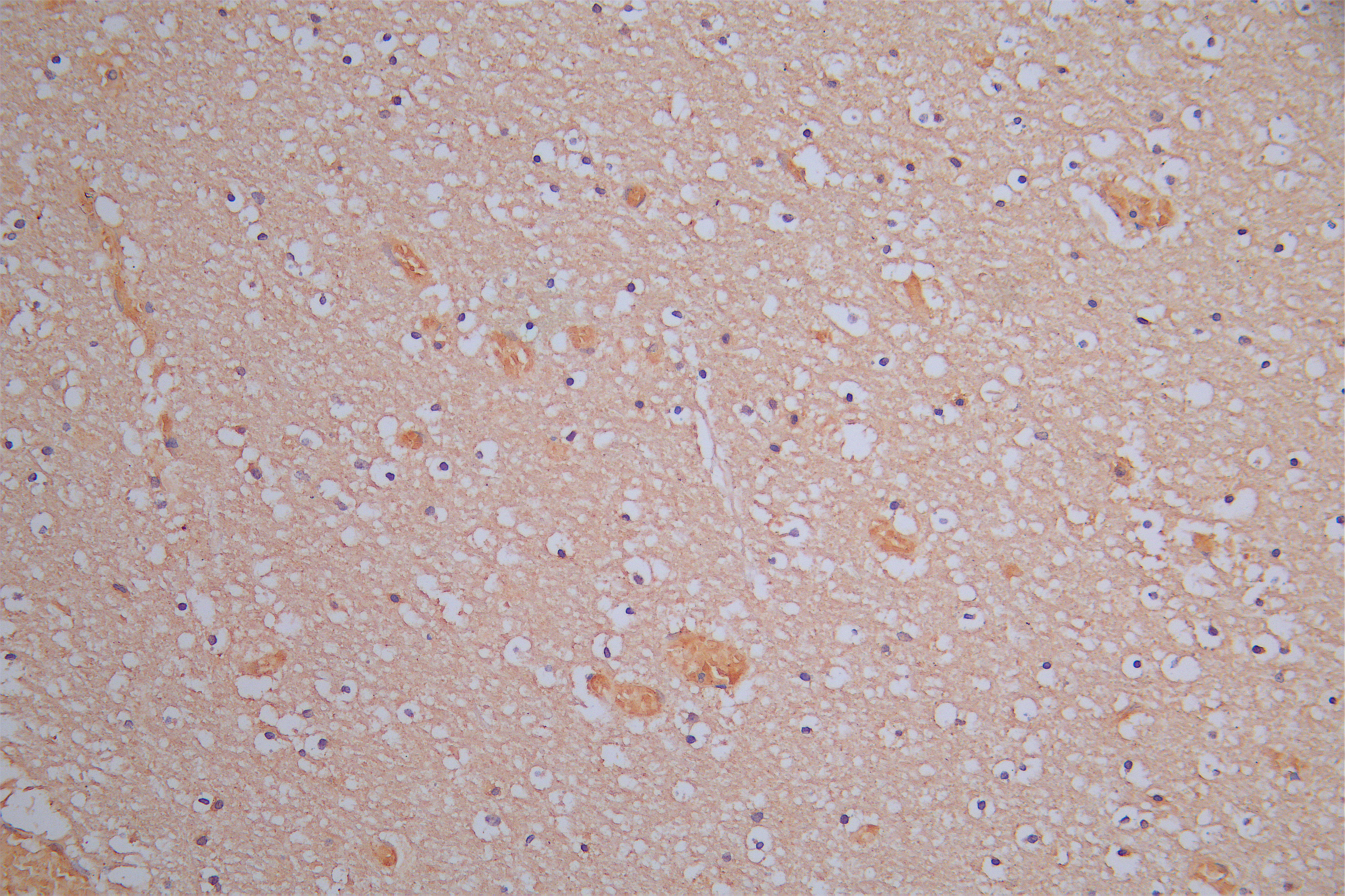 IHC image of CSB-RA614975MA1HU diluted at 1:150 and staining in paraffin-embedded human brain tissue performed on a Leica BondTM system. After dewaxing and hydration, antigen retrieval was mediated by high pressure in a citrate buffer (pH 6.0). Section was blocked with 10% normal goat serum 30min at RT. Then primary antibody (1% BSA) was incubated at 4°C overnight. The primary is detected by a Goat anti-Rabbit IgG labeled by HRP and visualized using 0.05% DAB.