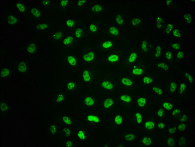 Immunofluorescence staining of Hela cells with CSB-RA618770A1981phHU at 1:100,counter-stained with DAPI. The cells were fixed in 4% formaldehyde, permeabilized using 0.2% Triton X-100 and blocked in 10% normal Goat Serum. The cells were then incubated with the antibody overnight at 4°C. The secondary antibody was Alexa Fluor 488-congugated AffiniPure Goat Anti-Rabbit IgG (H+L).