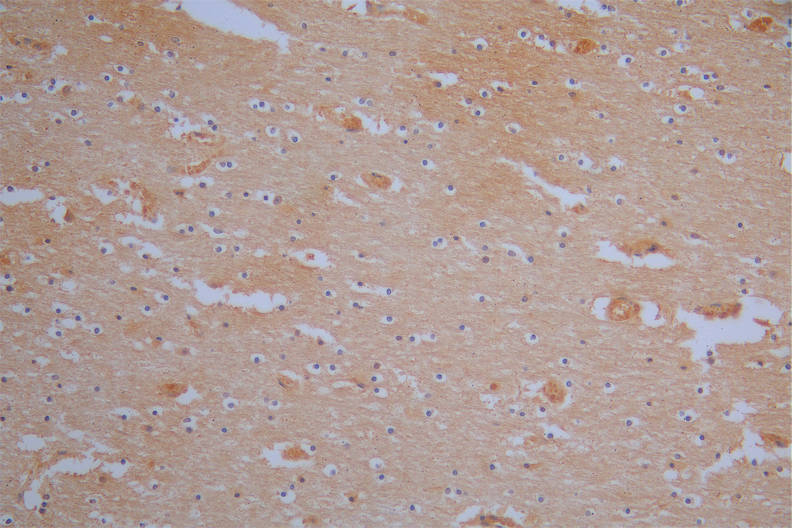 IHC image of CSB-RA619084MA1HU diluted at 1:200 and staining in paraffin-embedded human brain tissue performed on a Leica BondTM system. After dewaxing and hydration, antigen retrieval was mediated by high pressure in a citrate buffer (pH 6.0). Section was blocked with 10% normal goat serum 30min at RT. Then primary antibody (1% BSA) was incubated at 4°C overnight. The primary is detected by a Goat anti-Mouse IgG labeled by HRP and visualized using 0.05% DAB.