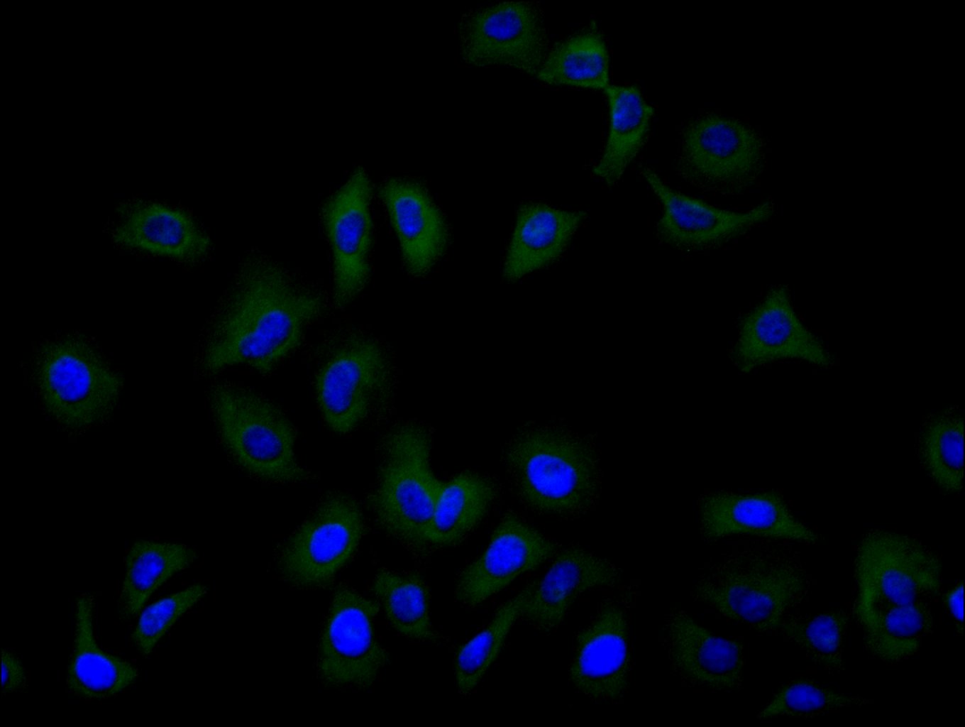 Immunofluorescence staining of Hela cell with CSB-RA620892MA1HU at 1:100, counter-stained with DAPI. The cells were fixed in 4% formaldehyde and blocked in 10% normal Goat Serum. The cells were then incubated with the antibody overnight at 4C. The secondary antibody was FITC-conjugated AffiniPure Goat Anti-Human IgG(H+L).