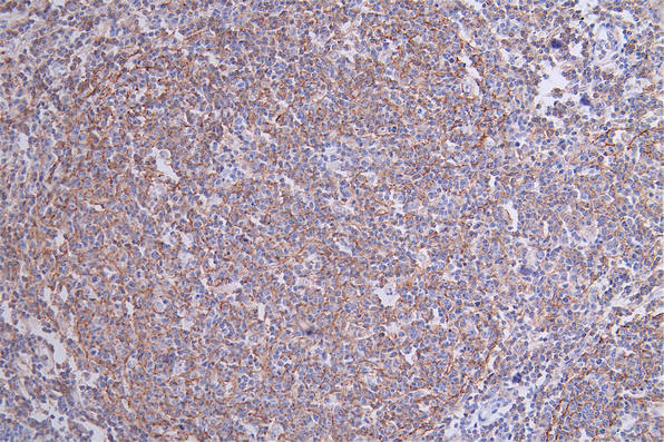 IHC image of CSB-RA783071A0HU diluted at 1:50 and staining in paraffin-embedded human tonsil tissue performed on a Leica BondTM system. After dewaxing and hydration, antigen retrieval was mediated by high pressure in a citrate buffer (pH 6.0). Section was blocked with 10% normal goat serum 30min at RT. Then primary antibody (1% BSA) was incubated at 4°C overnight. The primary is detected by a Goat anti-rabbit polymer IgG labeled by HRP and visualized using 0.17% DAB.