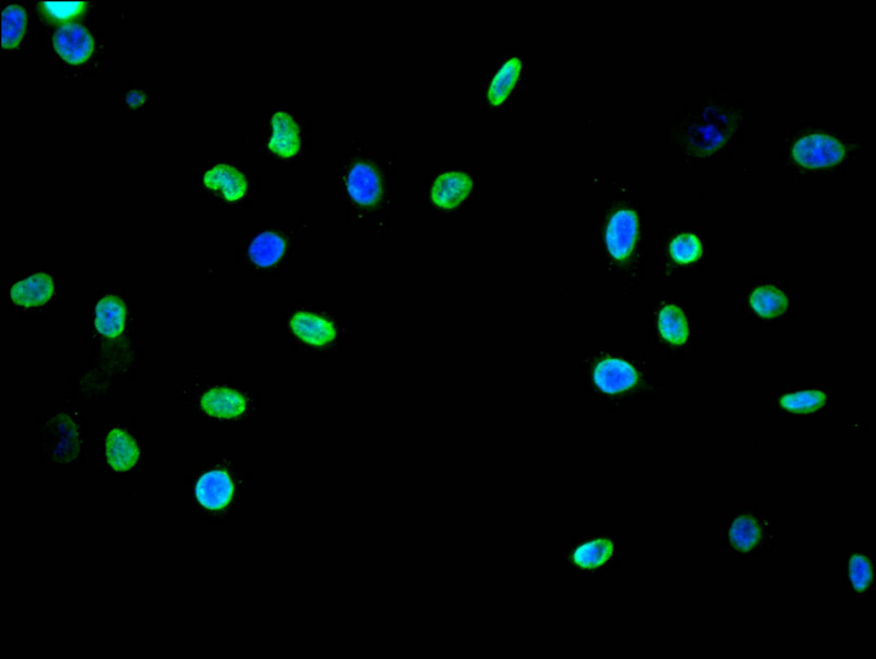 Immunofluorescence staining of A549 with CSB-RA792403A0HU at 1:20, counter-stained with DAPI. The cells were fixed in 4% formaldehyde and blocked in 10% normal Goat Serum. The cells were then incubated with the antibody overnight at 4°C. The secondary antibody was Alexa Fluor 489-congugated AffiniPure Goat Anti-Rabbit IgG(H+L).