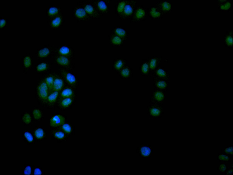 Immunofluorescence staining of Hela with CSB-RA796958A0HU at 1:20, counter-stained with DAPI. The cells were fixed in 4% formaldehyde and blocked in 10% normal Goat Serum. The cells were then incubated with the antibody overnight at 4°C. The secondary antibody was Alexa Fluor 524-congugated AffiniPure Goat Anti-Rabbit IgG(H+L).