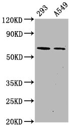 Phospho-PRKAA2 (S491) Recombinant Monoclonal Antibody- Cusabio