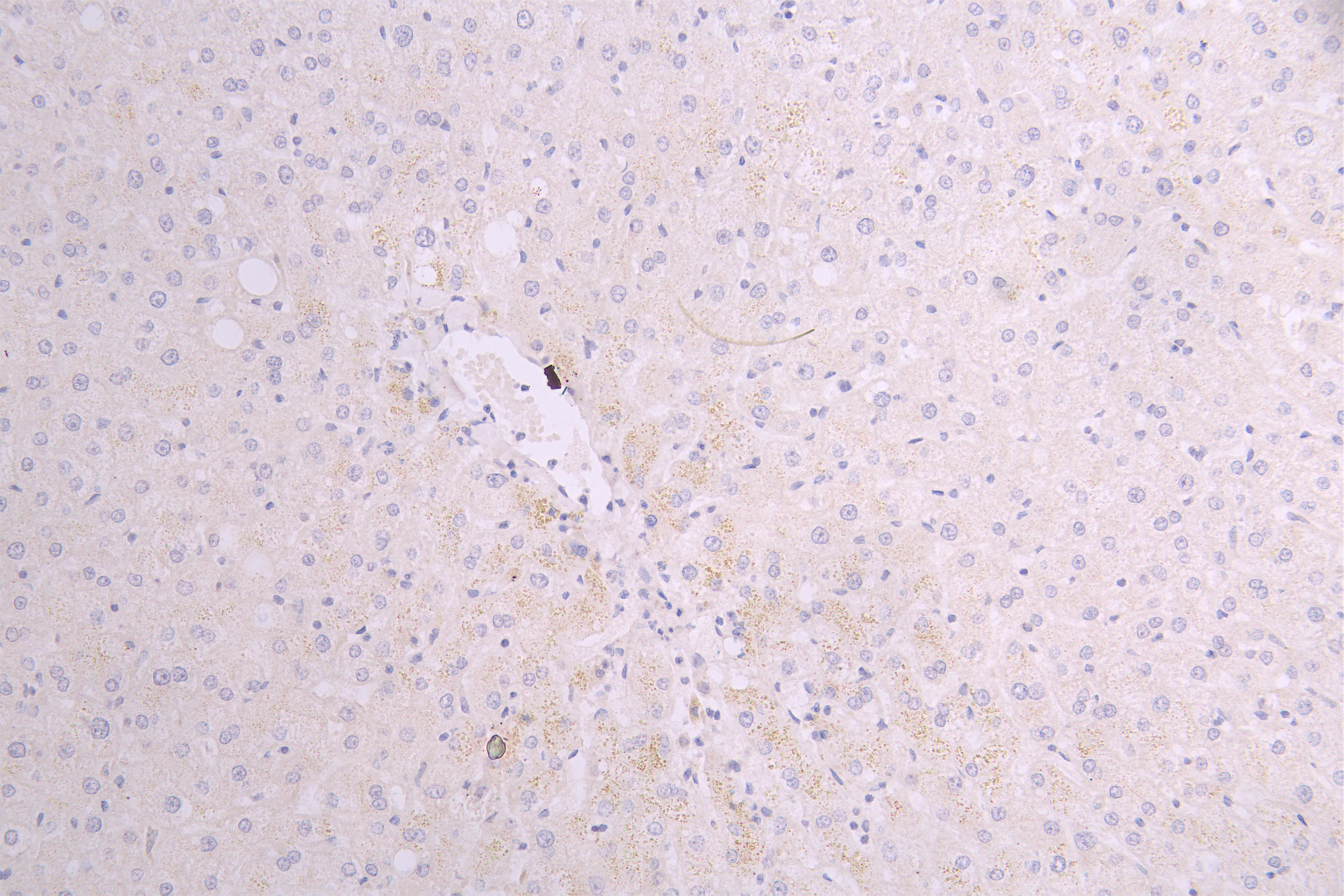 IHC image of CSB-RA858415MA1HU diluted at 1 : 100 and staining in paraffin-embedded human liver tissue performed on a Leica BondTM system. After dewaxing and hydration, antigen retrieval was mediated by high pressure in a citrate buffer (pH 6.0). Section was blocked with 10% normal goat serum 30min at RT. Then primary antibody (1% BSA) was incubated at 4°C overnight. The primary is detected by a Goat anti-human polymer IgG labeled by HRP and visualized using 0.05% DAB.