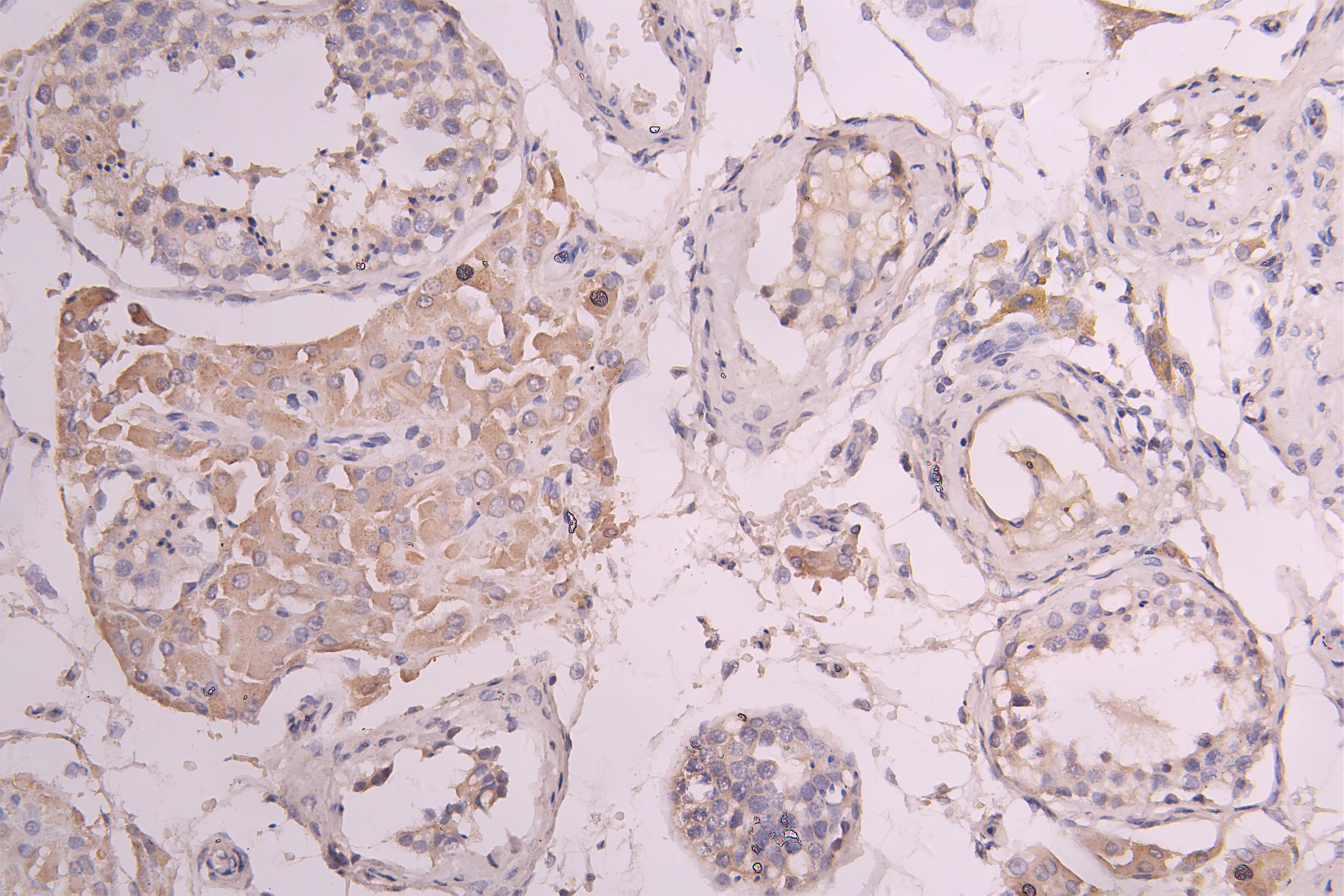 IHC image of CSB-RA860321MA1HU diluted at 1 : 100 and staining in paraffin-embedded human testis tissue performed on a Leica BondTM system. After dewaxing and hydration, antigen retrieval was mediated by high pressure in a citrate buffer (pH 6.0). Section was blocked with 10% normal goat serum 30min at RT. Then primary antibody (1% BSA) was incubated at 4°C overnight. The primary is detected by a Goat anti-human polymer IgG labeled by HRP and visualized using 0.05% DAB.