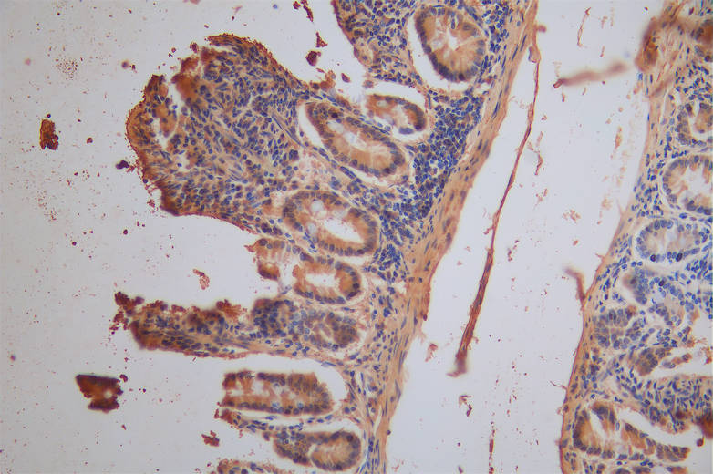 IHC image of CSB-RA878859MA1HU diluted at 1:200 and staining in paraffin-embedded human small intestine tissue performed on a Leica BondTM system. After dewaxing and hydration, antigen retrieval was mediated by high pressure in a citrate buffer (pH 6.0). Section was blocked with 10% normal goat serum 30min at RT. Then primary antibody (1% BSA) was incubated at 4°C overnight. The primary is detected by a Goat anti-Mouse IgG labeled by HRP and visualized using 0.05% DAB.