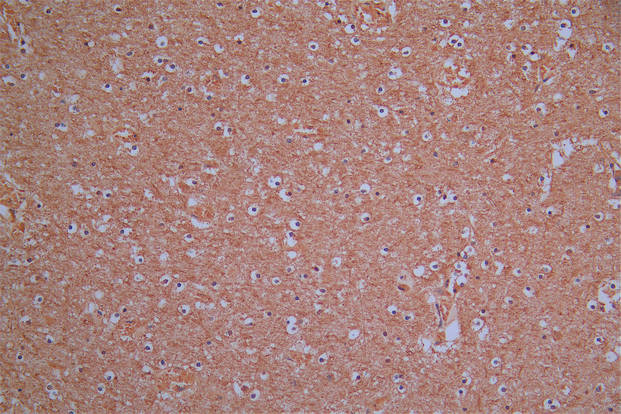 IHC image of CSB-RA896760MA1HU diluted at 1:30 and staining in paraffin-embedded human brain tissue performed on a Leica BondTM system. After dewaxing and hydration, antigen retrieval was mediated by high pressure in a citrate buffer (pH 6.0). Section was blocked with 10% normal goat serum 30min at RT. Then primary antibody (1% BSA) was incubated at 4°C overnight. The primary is detected by a Goat anti-Mouse IgG labeled by HRP and visualized using 0.05% DAB.