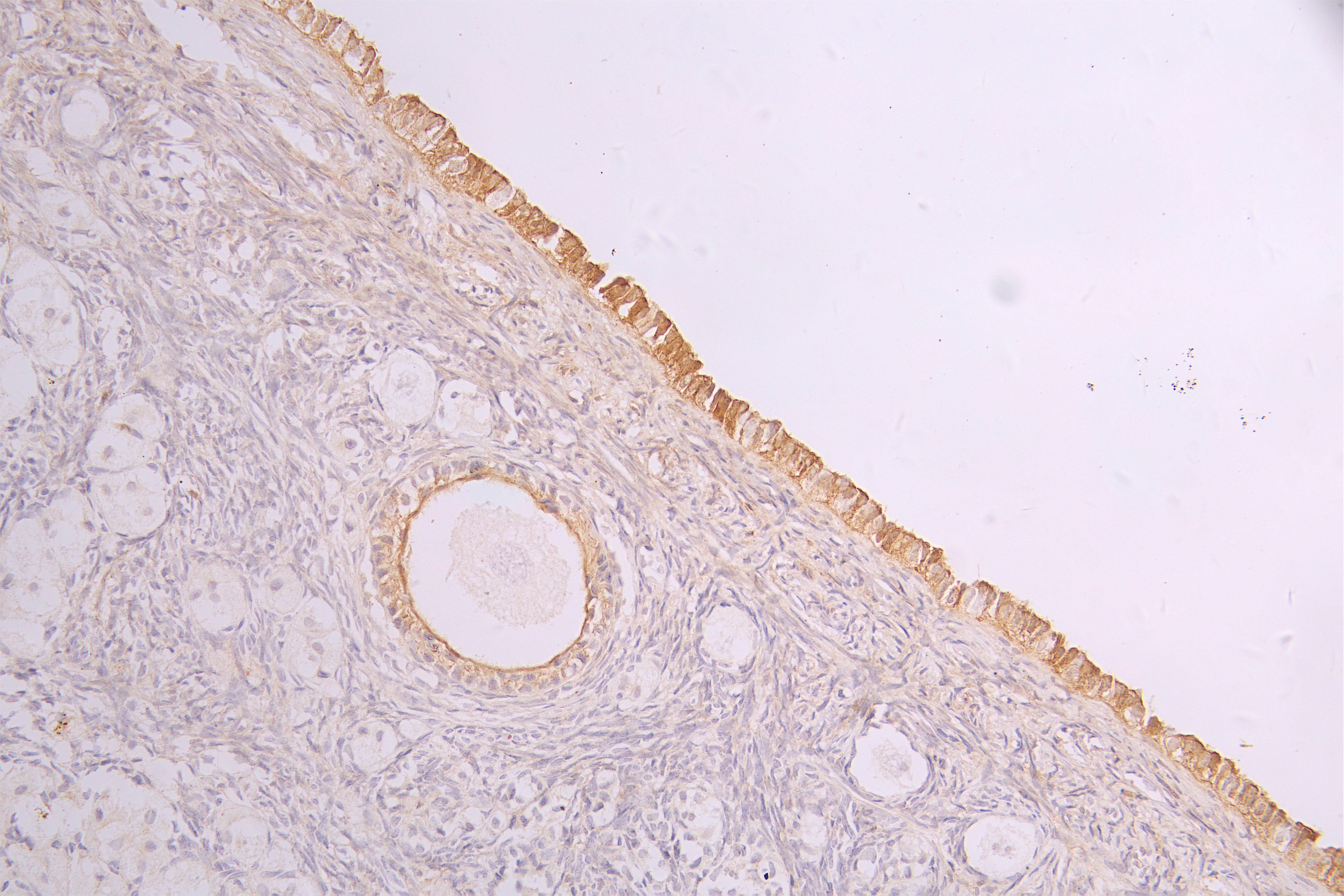 IHC image of CSB-RA932279MA1HU diluted at 1 : 100 and staining in paraffin-embedded human ovarian tissue performed on a Leica BondTM system. After dewaxing and hydration, antigen retrieval was mediated by high pressure in a citrate buffer (pH 6.0). Section was blocked with 10% normal goat serum 30min at RT. Then primary antibody (1% BSA) was incubated at 4°C overnight. The primary is detected by a Goat anti-human polymer IgG labeled by HRP and visualized using 0.05% DAB.