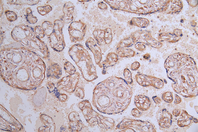 IHC image of CSB-RA940669A0HU diluted at 1:100 and staining in paraffin-embedded human placenta tissue performed on a Leica BondTM system. After dewaxing and hydration, antigen retrieval was mediated by high pressure in a citrate buffer (pH 6.0). Section was blocked with 10% normal goat serum 30min at RT. Then primary antibody (1% BSA) was incubated at 4°C overnight. The primary is detected by a Goat anti-rabbit polymer IgG labeled by HRP and visualized using 0.21% DAB.