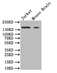 Western Blot Positive WB detected in: JK whole cell lysate, Mouse Brain tissue lysate All lanes: VEGF Receptor 1 antibody at 1:500 Secondary Goat polyclonal to rabbit IgG at 1/50000 dilution Predicted band size: 150 kDa Observed band size: 150 kDa