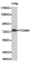 Western blot analysis of lung cell lysate using TICAM1 antibody.