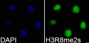 Immunofluorescence analysis of 293T cell using H3R8me2s antibody. Blue: DAPI for nuclear staining.