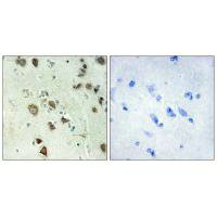 Immunohistochemistry analysis of paraffin-embedded human brain tissue using S6K-alpha6 antibody.