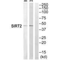 Western blot analysis of extracts from 293 cells and NIH/3T3 cells, using SIRT2 antibody.