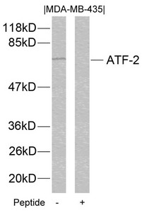 Western blot analysis of extracts from MDA-MB-435 cells using ATF2(Ab-112 or 94) Antibody and the same antibody preincubated with blocking peptide.