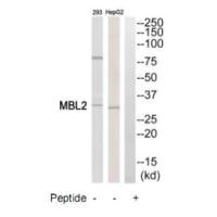 Western blot analysis of extracts from HepG2 cells and 293 cells, using MBL2 antibody.