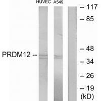 Western blot analysis of extracts from HUVEC cells and A549 cells, using PRDM12 antibody.